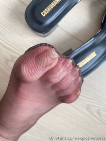 explosivetoess Meztelen Kiszivárgások OnlyFans Fotó 33