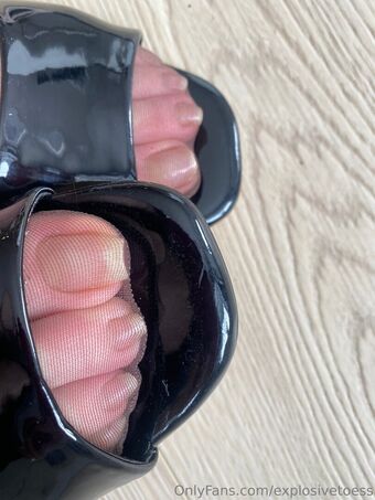 explosivetoess Meztelen Kiszivárgások OnlyFans Fotó 34