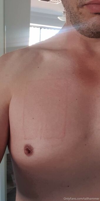tallhammer Meztelen Kiszivárgások OnlyFans Fotó 1